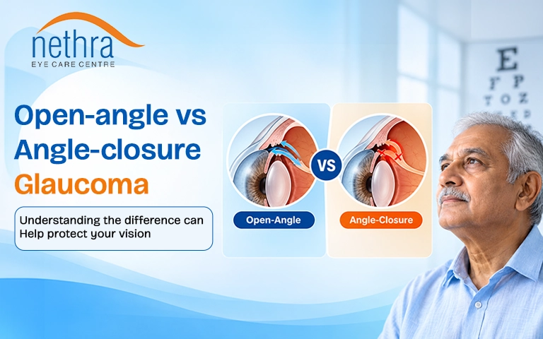open-angle-vs-angle-closure-glaucoma-treatment